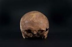 z'n teruggevonden schedel (nu te zien in het Stedelijk Museum Zwolle